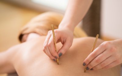 How Acupuncture Relieves Back Pain